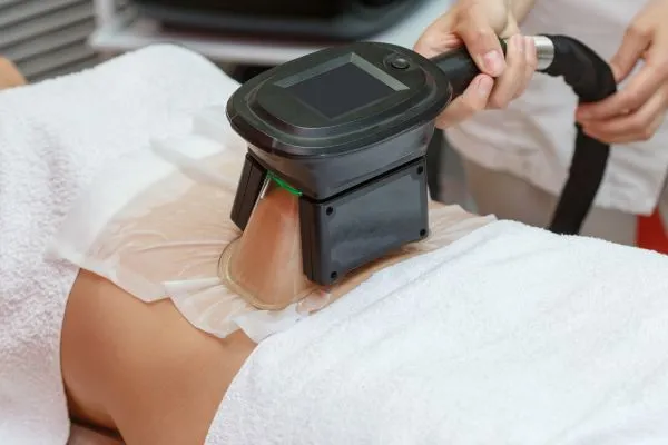 Image of person having fat freezing treatment to help weight gain Leeds