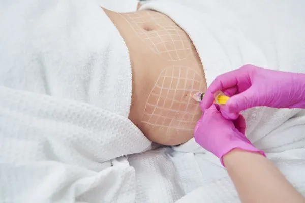 image of fat dissolving injections on love handles to help combat weight gain Leeds