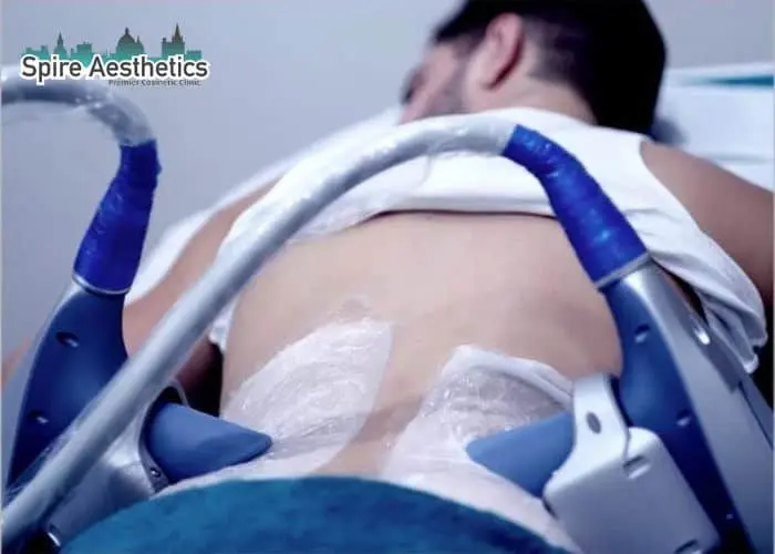 Man having fat freezing treatment done on love handles before a competitions Leeds to create a sculpted look.