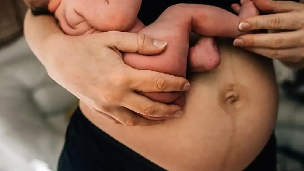 Why Is My Stomach Still Big After Pregnancy Leeds?